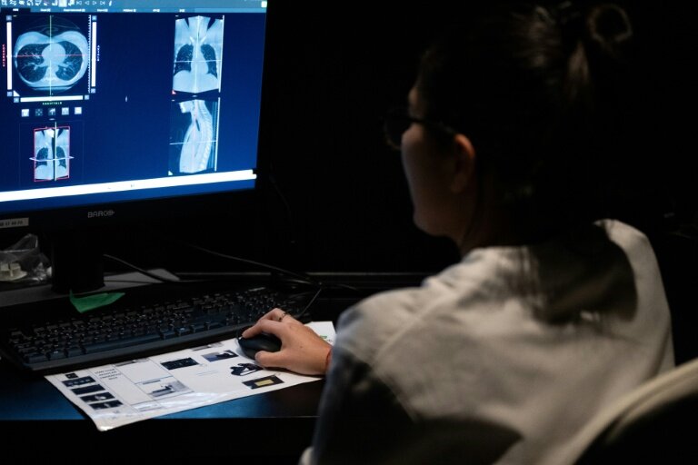 Une technicienne en radiologie médicale, travaille dans la salle de "tomographie volumique à faisceau conique" (CBCT) du centre médical Zoï, une start-up proposant des bilans de santé personnalisés à Paris, le 24 février 2026 © Anna KURTH