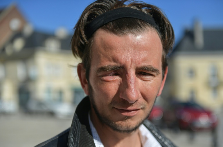 La justice n'est pas du cinéma: l'enquête sur un gilet jaune éborgné relancée