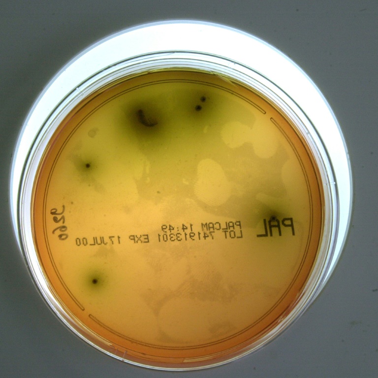 Listériose: 12 cas, dont 2 mortels, en lien avec des charcuteries d'une entreprise de la Drôme