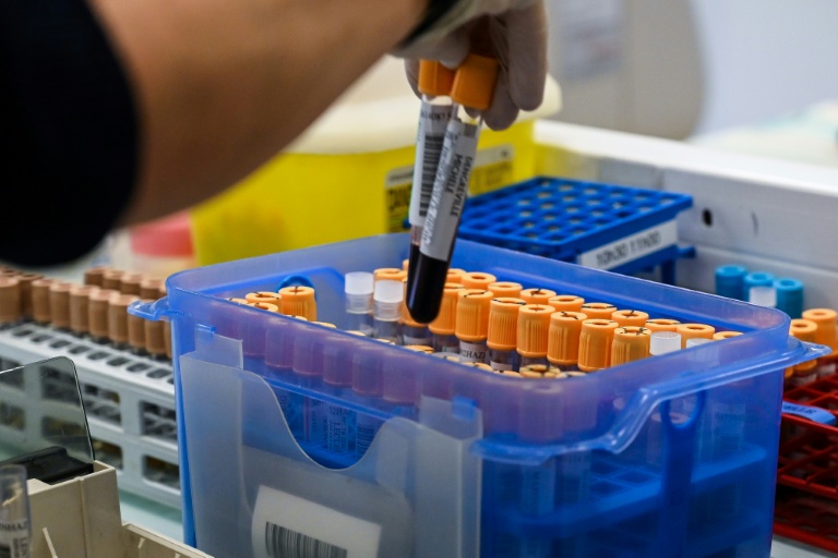 Tests ADN en accès libre: la question sensible d'une légalisation relancée en France