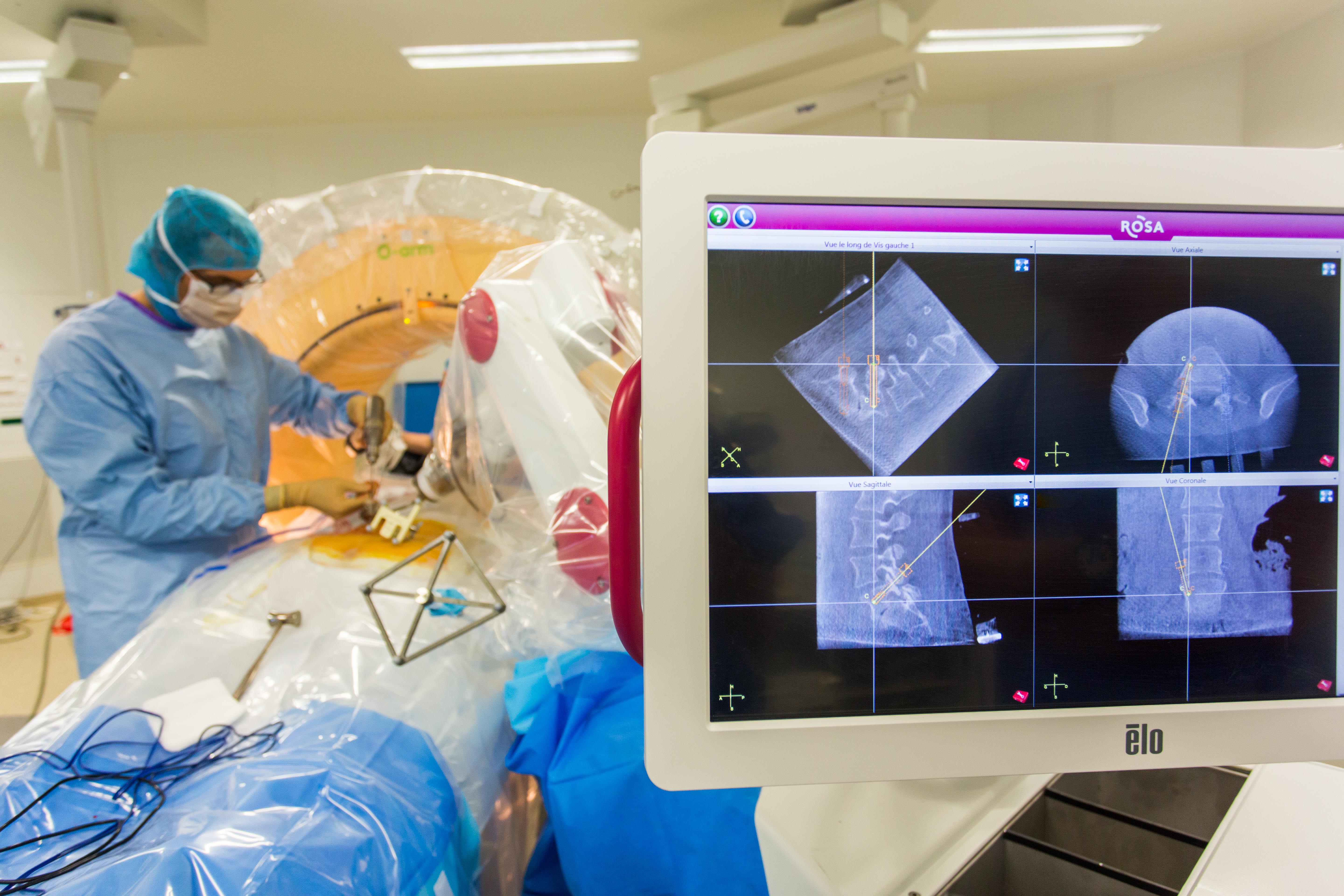 La chirurgie avec les robots en marche rapide