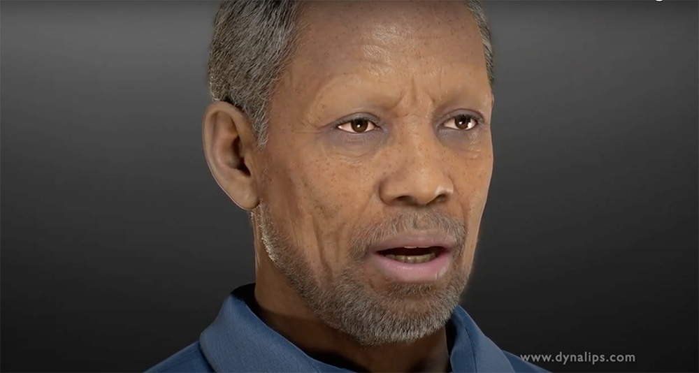 Dynalips est lancée à Nancy 