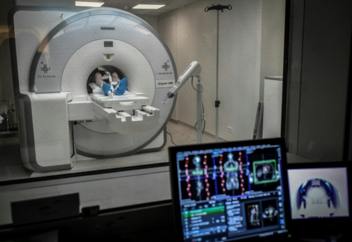 La mortalité en France, causée d'abord par les cancers et les maladies circulatoires, a atteint en 2023 un niveau "historiquement bas" essentiellement lié au reflux du Covid-19 © STEPHANE DE SAKUTIN