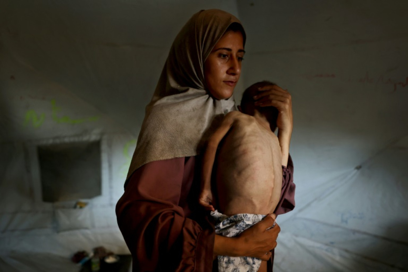 Hidaya, une mère palestinienne de 31 ans, porte son fils malade de 18 mois, Mohammed al-Mutawaq, qui présente des signes de malnutrition, au camp de réfugiés d'Al-Shati, à l'ouest de la ville de Gaza, le 24 juillet 2025 © Omar AL-QATTAA