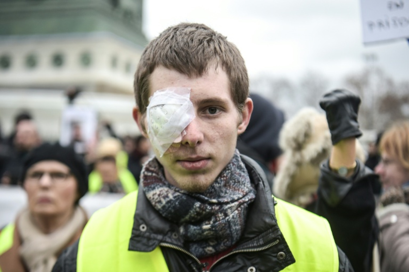 Franck Didron à Paris le 2 février 2019, deux mois après avoir été blessé lors d'une manifestation de gilets jaunes © LUCAS BARIOULET