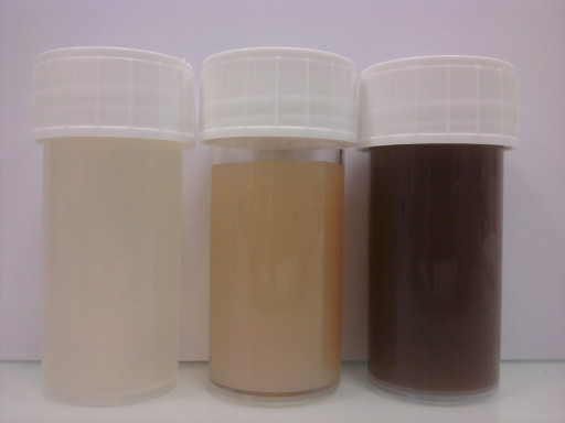 SON se repose sur l’INPI pour protéger ses innovations